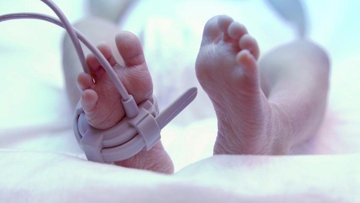 IDAI Ingatkan Bahaya Telur Mentah usai Bayi Alena Meninggal di Surabaya